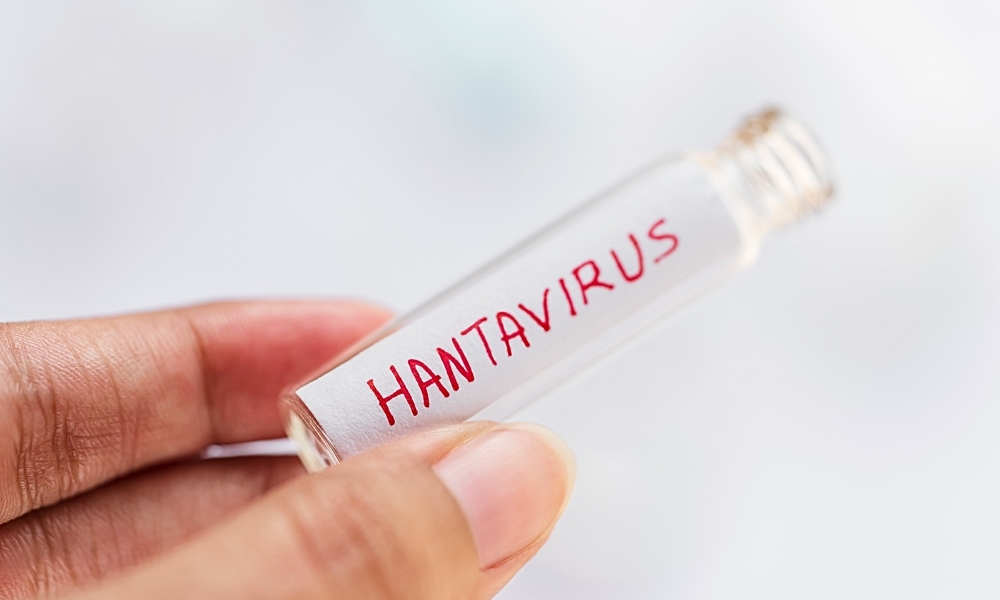 Hantavirus