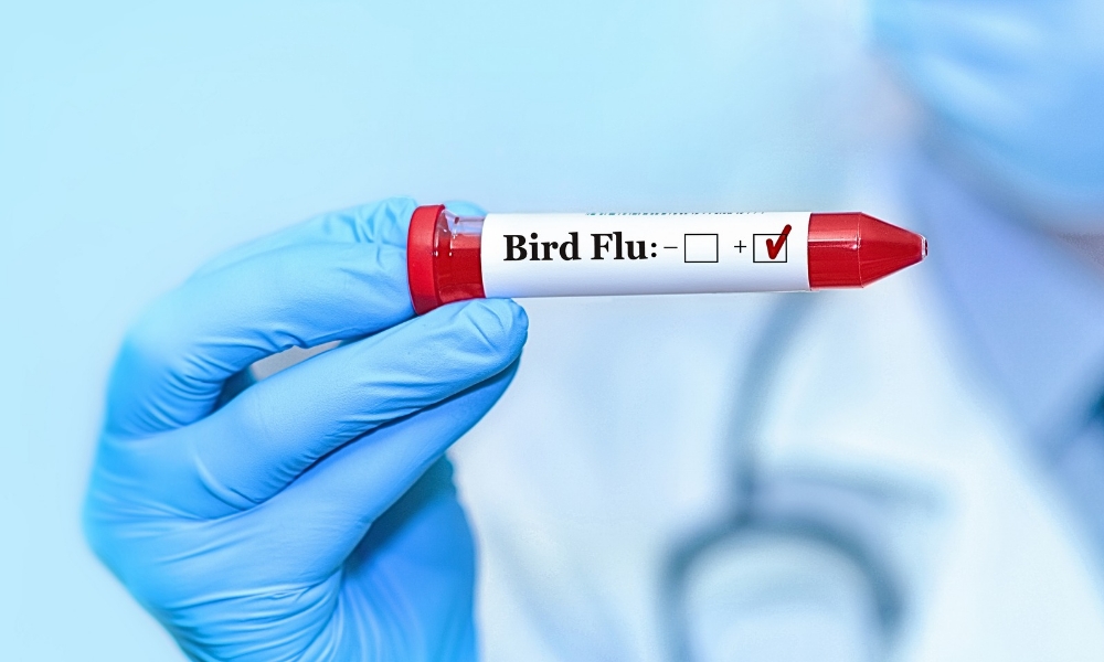 Flu burung